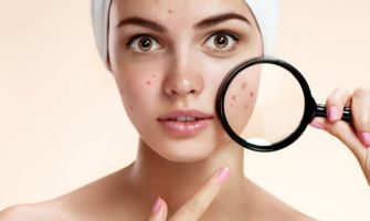 معالجة الالتهابات وحب الشباب